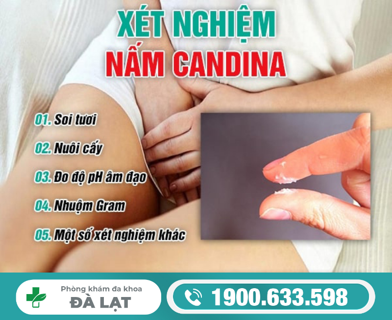 Hình ảnh minh họa